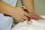 たかま鍼灸整骨院における肩こり治療に使われるスラッキング療法